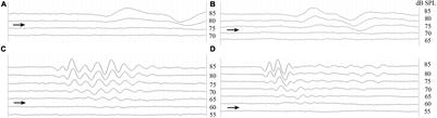 Effect of Temperature on the Plasticity of Peripheral Hearing Sensitivity to Airborne Sound in the Male Red-Eared Slider Trachemys scripta elegans